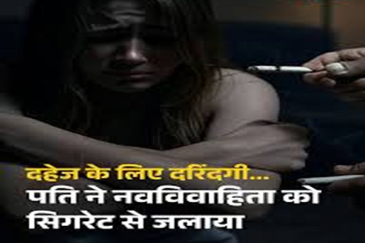 CRIME : क्रूरता की हदें पार ! दहेज के लिए दरिंदगी…पति ने नवविवाहिता को सिगरेट से जलाया